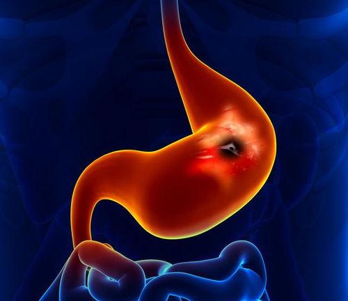 胃癌可以吃羊角瓜吗视频,胃癌患者饮食新选择？